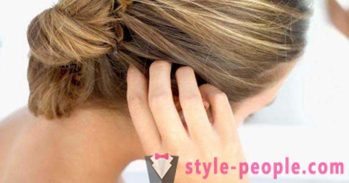 Γιατί να βλάψει τις ρίζες των μαλλιών στο κεφάλι: Αιτίες και θεραπείες
