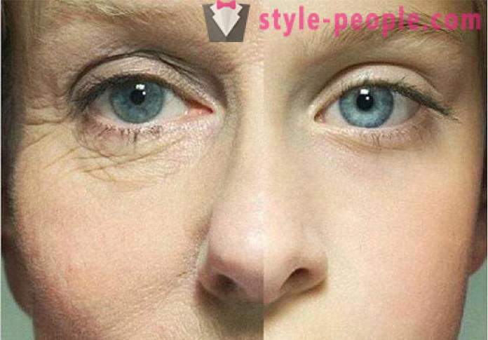 Η ηπαρίνη αλοιφή των ρυτίδων κάτω από τα μάτια: σχόλια, τα χαρακτηριστικά και την αποτελεσματικότητα εφαρμογής