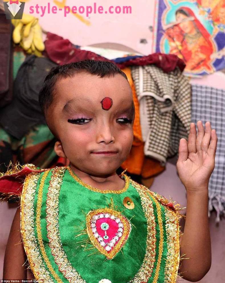 Το χωριό της Ινδίας λατρεύεται αγόρι με παραμορφωμένο το κεφάλι σαν θεός Γκανέσα