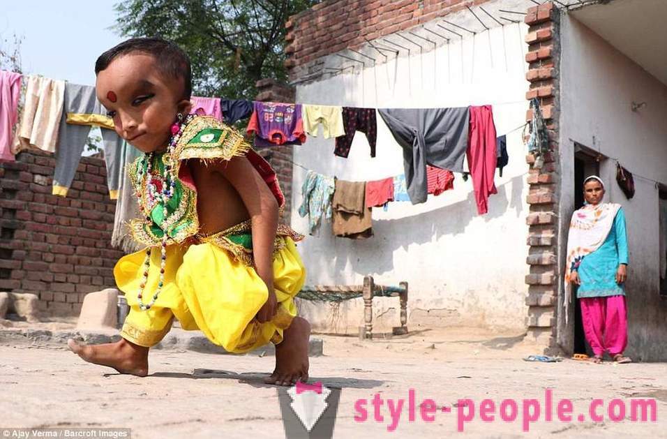 Το χωριό της Ινδίας λατρεύεται αγόρι με παραμορφωμένο το κεφάλι σαν θεός Γκανέσα
