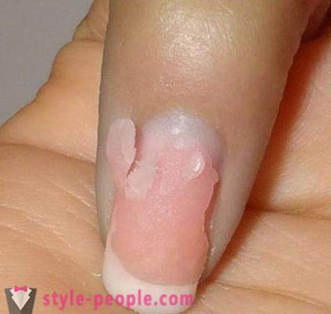 Πώς να αφαιρέσετε ακρυλικά νύχια στο σπίτι; Αφαίρεση ακρυλικά νύχια: Κριτικές
